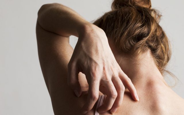 A Study Says to Stop Scratching Your Itches, and Rub Them Instead