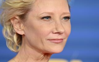 Anne Heche Not Expected To Survive