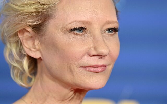 Anne Heche Not Expected To Survive